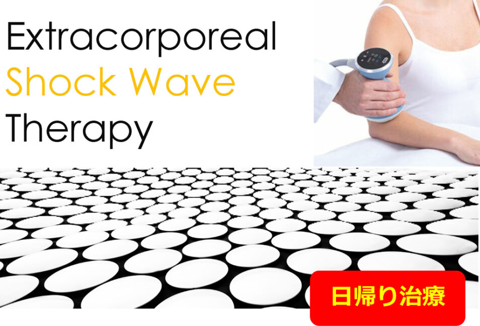 体外衝撃波治療　Extracorporeal Shock Wave Therapy　⽇帰り治療